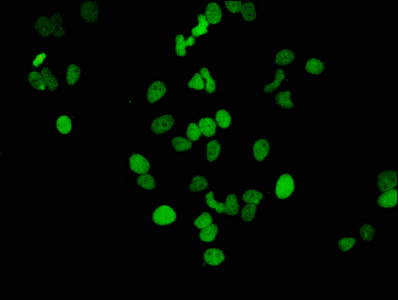 Immunofluorescence staining of Hela cells(treated by 15mM sodium butyrate for 30min) with CSB-RA010418A14acHU at 1:46,counter-stained with DAPI. The cells were fixed in 4% formaldehyde, permeabilized using 0.2% Triton X-100 and blocked in 10% normal Goat Serum. The cells were then incubated with the antibody overnight at 4°C.The secondary antibody was Alexa Fluor 488-congugated AffiniPure Goat Anti-Rabbit IgG (H+L).