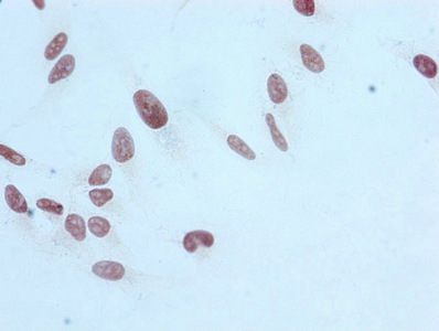 Mono-methyl-Histone H3.1 (R17) Recombinant Monoclonal Antibody - image 2