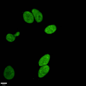 Mono-methyl-Histone H3.1 (R17) Recombinant Monoclonal Antibody - image 3