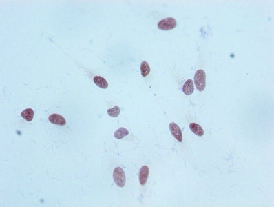 Mono-methyl-Histone H3.1 (K18) Recombinant Monoclonal Antibody - image 2