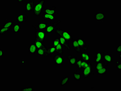 Immunofluorescence staining of Hela cells with CSB-RA010418A36me1HU at 1:37.5,counter-stained with DAPI. The cells were fixed in 4% formaldehyde, permeabilized using 0.2% Triton X-100 and blocked in 10% normal Goat Serum. The cells were then incubated with the antibody overnight at 4°C.The secondary antibody was Alexa Fluor 488-congugated AffiniPure Goat Anti-Rabbit IgG (H+L).