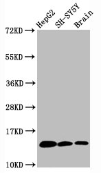 Western Blot Positive WB detected in HepG2 whole cell lysateH-SY5Y whole cell lysateat brain tissue All lanes Mono-methyl-Histone H3.1(K36)antibody at 0.6microg/ml Secondary Goat polyclonal to rabbit IgG at 1/50000 dilution Predicted band size: 15 KDa Observed band size: 15 KDa Western Blot Positive WB detected in HepG2 whole cell lysateH-SY5Y whole cell lysateat brain tissue All lanes Mono-methyl-Histone H3.1(K36)antibody at 0.6microg/ml Secondary Goat polyclonal to rabbit IgG at 1/50000 dilution Predicted band size: 15 KDa Observed band size: 15 KDa