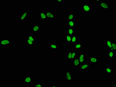Immunofluorescence staining of Hela cells(treated by 15mM sodium butyrate for 30min) with CSB-RA010429A05acHU at 1:65,counter-stained with DAPI. The cells were fixed in 4% formaldehyde, permeabilized using 0.2% Triton X-100 and blocked in 10% normal Goat Serum. The cells were then incubated with the antibody overnight at 4°C.The secondary antibody was Alexa Fluor 488-congugated AffiniPure Goat Anti-Rabbit IgG (H+L).