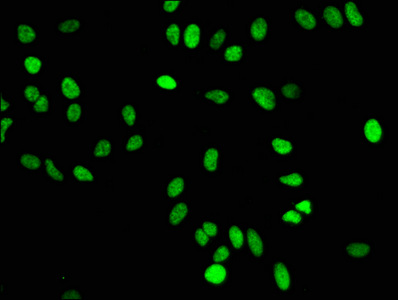 Immunofluorescence staining of Hela cells with CSB-RA010429A16me1HU at 1:50,counter-stained with DAPI. The cells were fixed in 4% formaldehyde, permeabilized using 0.2% Triton X-100 and blocked in 10% normal Goat Serum. The cells were then incubated with the antibody overnight at 4°C.The secondary antibody was Alexa Fluor 488-congugated AffiniPure Goat Anti-Rabbit IgG (H+L). Immunofluorescence staining of Hela cells with CSB-RA010429A16me1HU at 1:50,counter-stained with DAPI. The cells were fixed in 4% formaldehyde, permeabilized using 0.2% Triton X-100 and blocked in 10% normal Goat Serum. The cells were then incubated with the antibody overnight at 4°C.The secondary antibody was Alexa Fluor 488-congugated AffiniPure Goat Anti-Rabbit IgG (H+L).