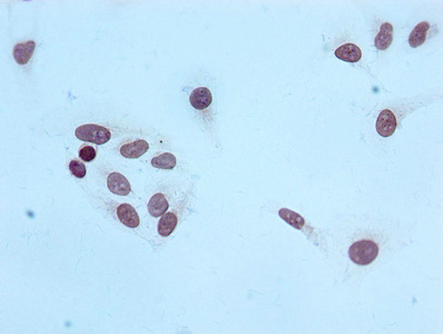 Immunocytochemistry analysis of CSB-RA010429A20me3HU diluted at 1:100 and staining in Hela cells performed on a Leica BondTM system. After dewaxing and hydration, antigen retrieval was mediated by high pressure in a citrate buffer (pH 6.0). Section was blocked with 10% normal goat serum 30min at RT. Then primary antibody (1% BSA) was incubated at 4°C overnight. The primary is detected by a biotinylated secondary antibody and visualized using an HRP conjugated SP system.