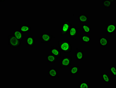 Immunofluorescence staining of A549 cells with CSB-RA010611A0HU at 1:43.5, counter-stained with DAPI. The cells were fixed in 4% formaldehyde, permeabilized using 0.2% Triton X-100 and blocked in 10% normal Goat Serum. The cells were then incubated with the antibody overnight at 4°C. The secondary antibody was Alexa Fluor 488-congugated AffiniPure Goat Anti-Rabbit IgG (H+L).