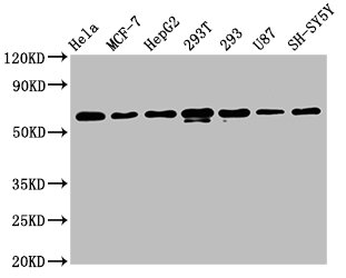 Western Blot Positive WB detected in: Hela whole cell lysate, MCF-7 whole cell lysate, HepG2 whole cell lysate, 293T whole cell lysate, 293 whole cell lysate, U87 whole cell lysate, SH-SY5Y whole cell lysate All lanes: HNRNPK antibody at 1.3microg/ml Secondary Goat polyclonal to rabbit IgG at 1/50000 dilution Predicted band size: 51, 52, 49 KDa Observed band size: 60 KDa Western Blot Positive WB detected in: Hela whole cell lysate, MCF-7 whole cell lysate, HepG2 whole cell lysate, 293T whole cell lysate, 293 whole cell lysate, U87 whole cell lysate, SH-SY5Y whole cell lysate All lanes: HNRNPK antibody at 1.3microg/ml Secondary Goat polyclonal to rabbit IgG at 1/50000 dilution Predicted band size: 51, 52, 49 KDa Observed band size: 60 KDa