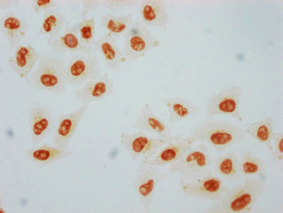 Phospho-HSF1 (S326) Recombinant Monoclonal Antibody - image 1