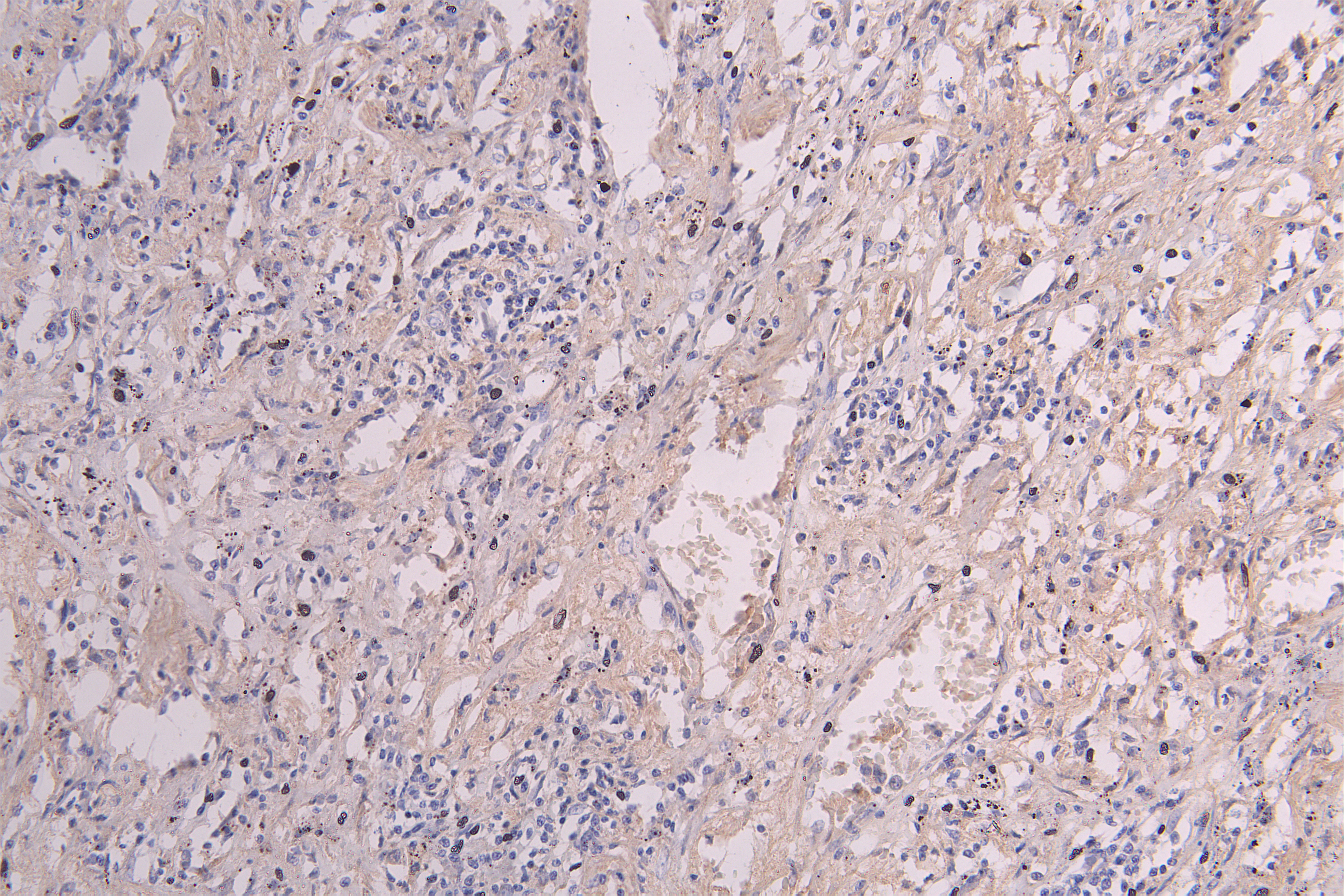CSB-RA011048MA1HU