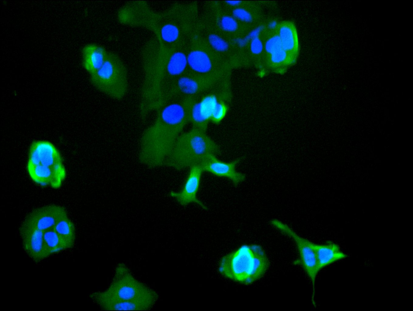 CSB-RA011087MA2HU
