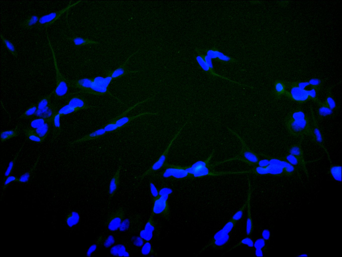 CSB-RA011087MA2HU