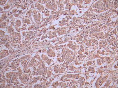 CSB-RA011087MA2HU