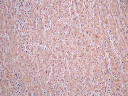 CSB-RA011087MA2HU