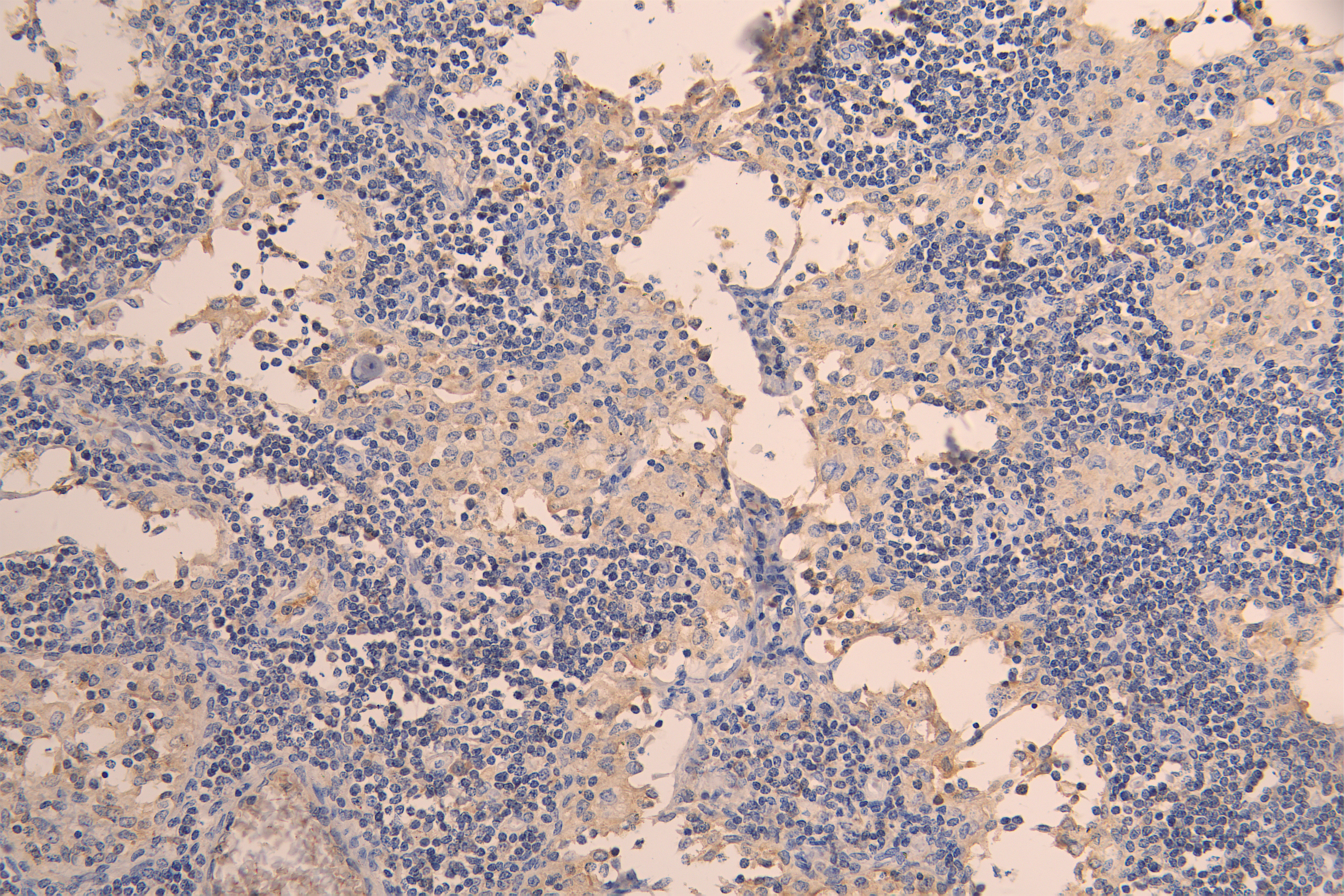 CSB-RA011587MA1HU