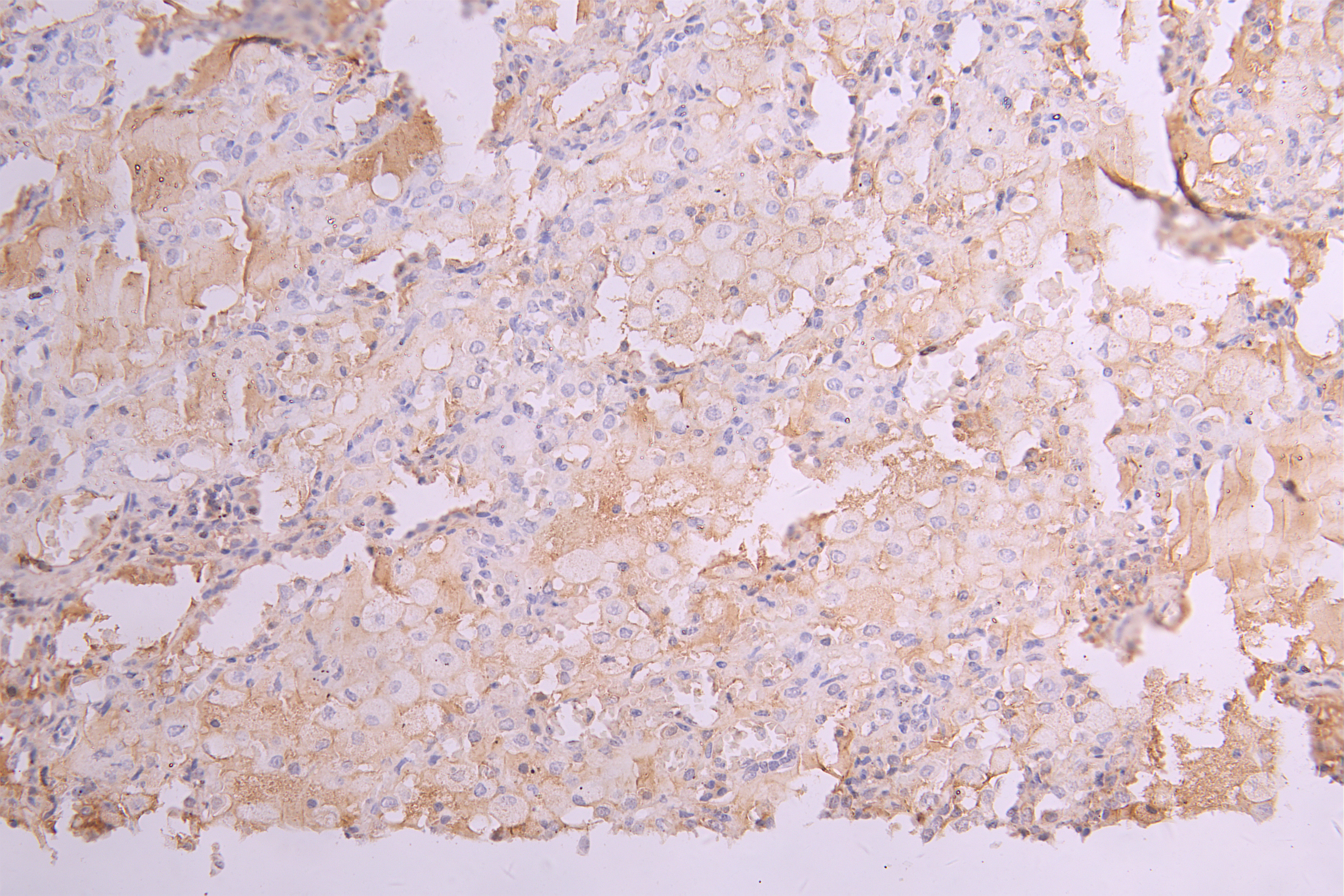 CSB-RA012352MA1HU