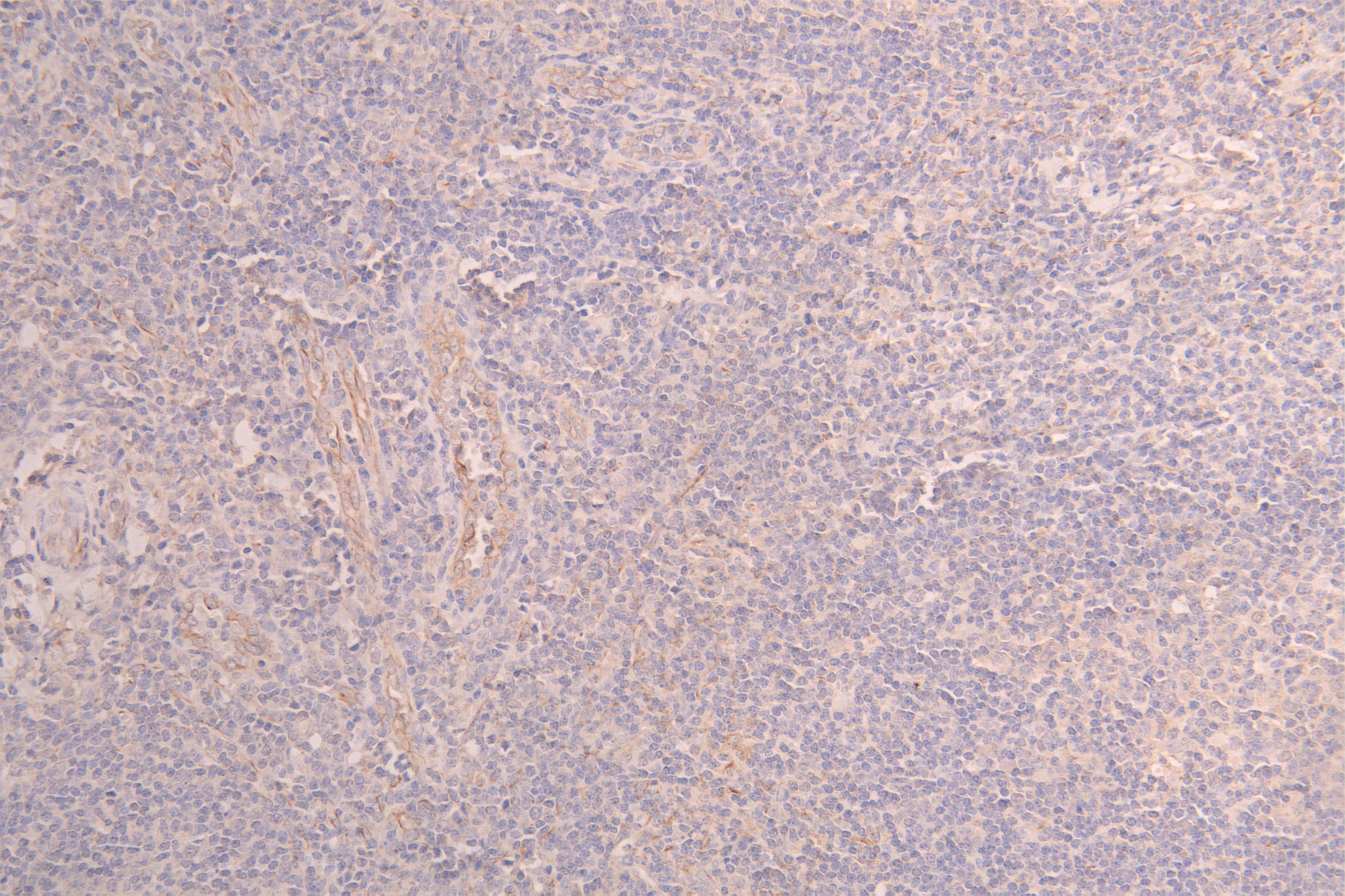 CSB-RA012719MA1HU