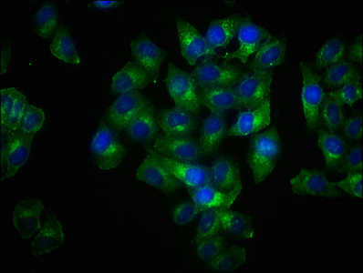 Immunofluorescence staining of Hela cells with CSB-RA012767A191phHU at 1:100,counter-stained with DAPI. The cells were fixed in 4% formaldehyde, permeabilized using 0.2% Triton X-100 and blocked in 10% normal Goat Serum. The cells were then incubated with the antibody overnight at 4°C. The secondary antibody was Alexa Fluor 488-congugated AffiniPure Goat Anti-Rabbit IgG (H+L).