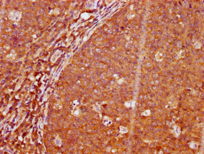 IHC image of CSB-RA012767A191phHU diluted at 1:100 and staining in paraffin-embedded human tonsil tissue performed on a Leica BondTM system. After dewaxing and hydration, antigen retrieval was mediated by high pressure in a citrate buffer (pH 6.0). Section was blocked with 10% normal goat serum 30min at RT. Then primary antibody (1% BSA) was incubated at 4°C overnight. The primary is detected by a biotinylated secondary antibody and visualized using an HRP conjugated SP system.