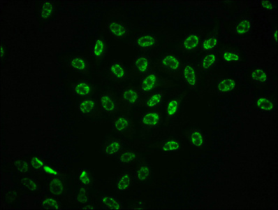 Phospho-MAPK3 (T202) + MAPK1 (T185) Recombinant Monoclonal Antibody - image 3
