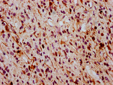 Phospho-MAPK3 (T202) + MAPK1 (T185) Recombinant Monoclonal Antibody - image 2