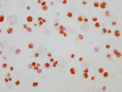 Phospho-MAPK8/MAPK9/MAPK10 (T183/T183/T221) Recombinant Monoclonal Antibody - image 2