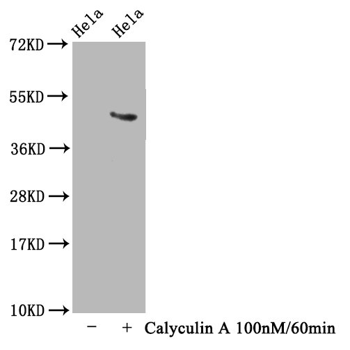 Western Blot Positive WB detected in Hela whole cell lysate(treated with Calyculin A or not) All lanes Phospho-MAPT antibody at 1.63microg/ml Secondary Goat polyclonal to rabbit IgG at 1/50000 dilution Predicted band size: 46 KDa Observed band size: 46 KDa Western Blot Positive WB detected in Hela whole cell lysate(treated with Calyculin A or not) All lanes Phospho-MAPT antibody at 1.63microg/ml Secondary Goat polyclonal to rabbit IgG at 1/50000 dilution Predicted band size: 46 KDa Observed band size: 46 KDa