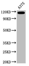 Western Blot Positive WB detected in A375 whole cell lysate All lanes CD146 antibody at 0.6microg/ml Secondary Goat polyclonal to rabbit IgG at 1/50000 dilution Predicted band size: 72 KDa Observed band size: 120 KDa Western Blot Positive WB detected in A375 whole cell lysate All lanes CD146 antibody at 0.6microg/ml Secondary Goat polyclonal to rabbit IgG at 1/50000 dilution Predicted band size: 72 KDa Observed band size: 120 KDa