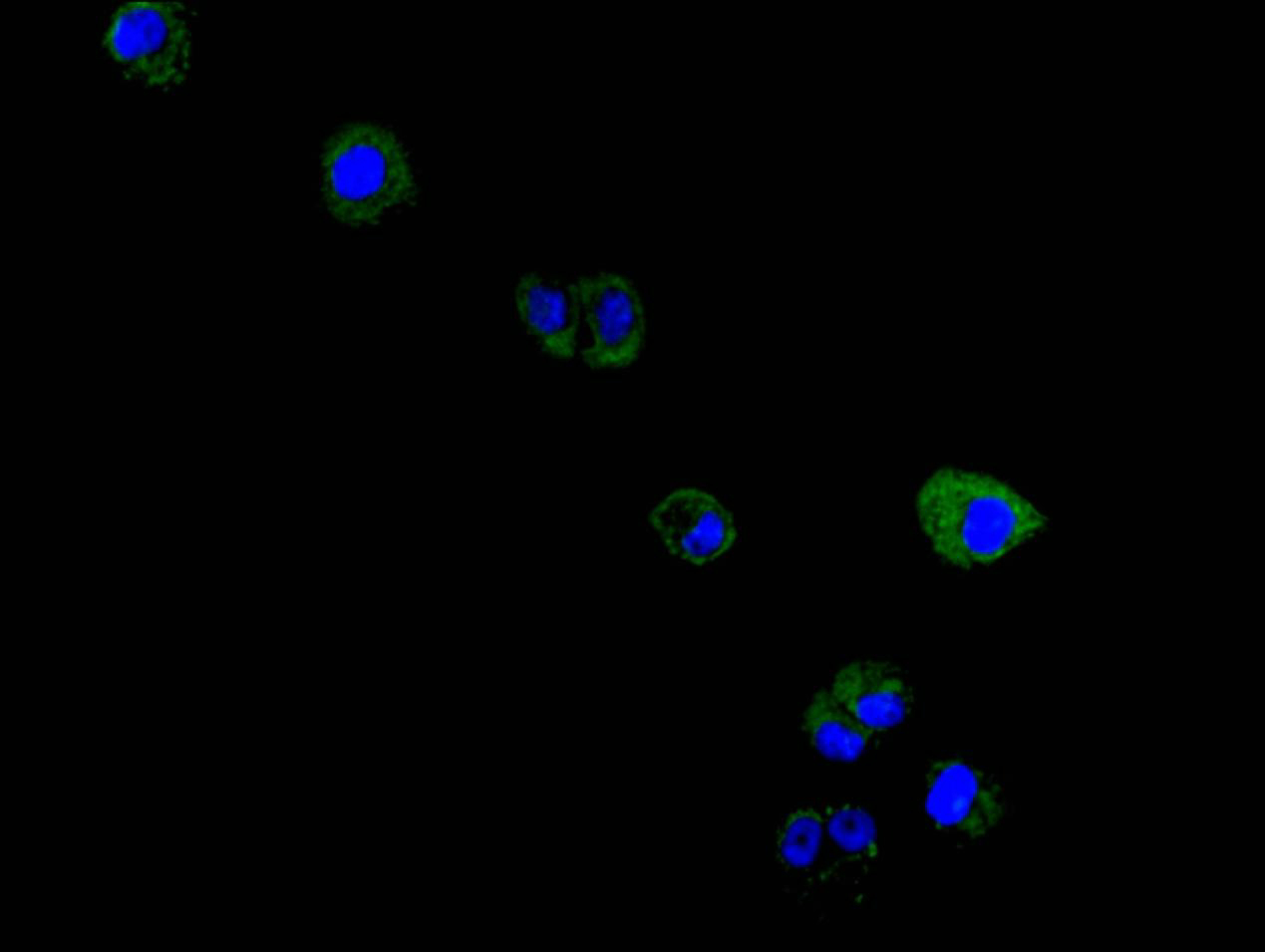 CSB-RA015007MA4HU TEM