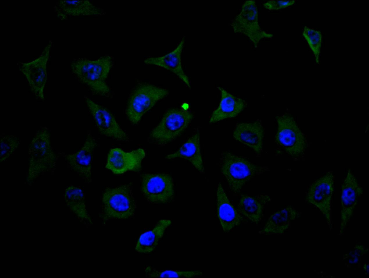 CSB-RA015007MA4HU TEM