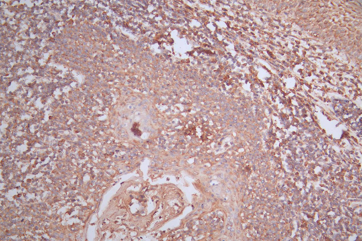 CSB-RA015007MA4HU IHC