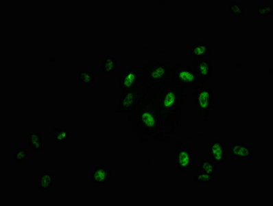 Immunofluorescence staining of Hela cells with CSB-RA015261A11phHU at 1:100,counter-stained with DAPI. The cells were fixed in 4% formaldehyde, permeabilized using 0.2% Triton X-100 and blocked in 10% normal Goat Serum. The cells were then incubated with the antibody overnight at 4°C. The secondary antibody was Alexa Fluor 488-congugated AffiniPure Goat Anti-Rabbit IgG (H+L). Immunofluorescence staining of Hela cells with CSB-RA015261A11phHU at 1:100,counter-stained with DAPI. The cells were fixed in 4% formaldehyde, permeabilized using 0.2% Triton X-100 and blocked in 10% normal Goat Serum. The cells were then incubated with the antibody overnight at 4°C. The secondary antibody was Alexa Fluor 488-congugated AffiniPure Goat Anti-Rabbit IgG (H+L).