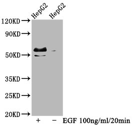Western Blot Positive WB detected in HepG2 whole cell lysate(treated with EGF or not) All lanes Phospho-MYC antibody at 0.99microg/ml Secondary Goat polyclonal to rabbit IgG at 1/50000 dilution Predicted band size: 57 KDa Observed band size: 57 KDa Western Blot Positive WB detected in HepG2 whole cell lysate(treated with EGF or not) All lanes Phospho-MYC antibody at 0.99microg/ml Secondary Goat polyclonal to rabbit IgG at 1/50000 dilution Predicted band size: 57 KDa Observed band size: 57 KDa