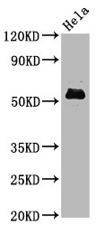 Western Blot Positive WB detected in Hela whole cell lysate All lanes Phospho-MYC antibody at 1.4microg/ml Secondary Goat polyclonal to rabbit IgG at 1/50000 dilution Predicted band size: 57 KDa Observed band size: 57 KDa Western Blot Positive WB detected in Hela whole cell lysate All lanes Phospho-MYC antibody at 1.4microg/ml Secondary Goat polyclonal to rabbit IgG at 1/50000 dilution Predicted band size: 57 KDa Observed band size: 57 KDa
