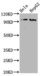 Western Blot Positive WB detected in Hela whole cell lysate,HepG2 whole cell lysate All lanes Phospho-NBN antibody at 1.98microg/ml Secondary Goat polyclonal to rabbit IgG at 1/50000 dilution Predicted band size: 95 KDa Observed band size: 95 KDa Western Blot Positive WB detected in Hela whole cell lysate,HepG2 whole cell lysate All lanes Phospho-NBN antibody at 1.98microg/ml Secondary Goat polyclonal to rabbit IgG at 1/50000 dilution Predicted band size: 95 KDa Observed band size: 95 KDa