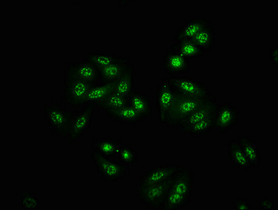 Immunofluorescence staining of HepG2 cells(treated with 50mM Calyculin A for 30min) with CSB-RA017408A474phHU at 1:100,counter-stained with DAPI. The cells were fixed in 4% formaldehyde, permeabilized using 0.2% Triton X-100 and blocked in 10% normal Goat Serum. The cells were then incubated with the antibody overnight at 4°C. The secondary antibody was Alexa Fluor 488-congugated AffiniPure Goat Anti-Rabbit IgG (H+L).