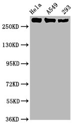 Western Blot Positive WB detected in Hela whole cell lysate,A549 whole cell lysate,293 whole cell lysate All lanes Phospho-POLR2A antibody at 1.02microg/ml Secondary Goat polyclonal to rabbit IgG at 1/50000 dilution Predicted band size: 270 KDa Observed band size: 270 KDa Western Blot Positive WB detected in Hela whole cell lysate,A549 whole cell lysate,293 whole cell lysate All lanes Phospho-POLR2A antibody at 1.02microg/ml Secondary Goat polyclonal to rabbit IgG at 1/50000 dilution Predicted band size: 270 KDa Observed band size: 270 KDa