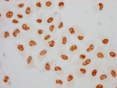 Immunocytochemistry analysis of CSB-RA018327A05phHU diluted at 1:75 and staining in Hela cells(treated with 100ng/ml EGF for 4h) performed on a Leica BondTM system. The cells were fixed in 4% formaldehyde, permeabilized using 0.2% Triton X-100 and blocked with 10% normal goat serum 30min at RT. Then primary antibody (1% BSA) was incubated at 4°C overnight. The primary is detected by a biotinylated secondary antibody and visualized using an HRP conjugated SP system.