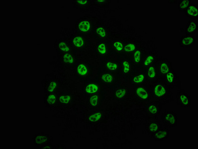 Immunofluorescence staining of Hela cells with CSB-RA018327A05phHU at 1:100,counter-stained with DAPI. The cells were fixed in 4% formaldehyde, permeabilized using 0.2% Triton X-100 and blocked in 10% normal Goat Serum. The cells were then incubated with the antibody overnight at 4°C. The secondary antibody was Alexa Fluor 488-congugated AffiniPure Goat Anti-Rabbit IgG (H+L).