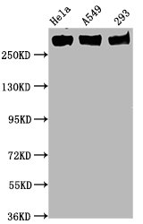 Western Blot Positive WB detected in Hela whole cell lysate,A549 whole cell lysate,293 whole cell lysate All lanes Phospho-POLR2A antibody at 0.75microg/ml Secondary Goat polyclonal to rabbit IgG at 1/50000 dilution Predicted band size: 270 KDa Observed band size: 270 KDa Western Blot Positive WB detected in Hela whole cell lysate,A549 whole cell lysate,293 whole cell lysate All lanes Phospho-POLR2A antibody at 0.75microg/ml Secondary Goat polyclonal to rabbit IgG at 1/50000 dilution Predicted band size: 270 KDa Observed band size: 270 KDa
