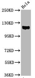 Western Blot Positive WB detected in Hela whole cell lysate All lanes Phospho-PTK2 antibody at 3.05microg/ml Secondary Goat polyclonal to rabbit IgG at 1/50000 dilution Predicted band size: 119 KDa Observed band size: 119 KDa Western Blot Positive WB detected in Hela whole cell lysate All lanes Phospho-PTK2 antibody at 3.05microg/ml Secondary Goat polyclonal to rabbit IgG at 1/50000 dilution Predicted band size: 119 KDa Observed band size: 119 KDa