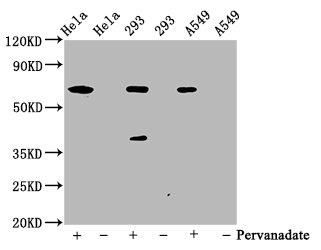 Western Blot Positive WB detected in Hela whole cell lysate?93 whole cell lysate549 whole cell lysate(treated with Pervanadate or not) All lanes Phospho-PTPN11 antibody at 0.65microg/ml Secondary Goat polyclonal to rabbit IgG at 1/50000 dilution Predicted band size: 68 KDa Observed band size: 68 KDa Western Blot Positive WB detected in Hela whole cell lysate?93 whole cell lysate549 whole cell lysate(treated with Pervanadate or not) All lanes Phospho-PTPN11 antibody at 0.65microg/ml Secondary Goat polyclonal to rabbit IgG at 1/50000 dilution Predicted band size: 68 KDa Observed band size: 68 KDa