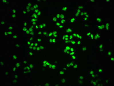 Immunofluorescence staining of K562 cells with CSB-RA019386A807phHU at 1:100,counter-stained with DAPI. The cells were fixed in 4% formaldehyde, permeabilized using 0.2% Triton X-100 and blocked in 10% normal Goat Serum. The cells were then incubated with the antibody overnight at 4°C. The secondary antibody was Alexa Fluor 488-congugated AffiniPure Goat Anti-Rabbit IgG (H+L). Immunofluorescence staining of K562 cells with CSB-RA019386A807phHU at 1:100,counter-stained with DAPI. The cells were fixed in 4% formaldehyde, permeabilized using 0.2% Triton X-100 and blocked in 10% normal Goat Serum. The cells were then incubated with the antibody overnight at 4°C. The secondary antibody was Alexa Fluor 488-congugated AffiniPure Goat Anti-Rabbit IgG (H+L).