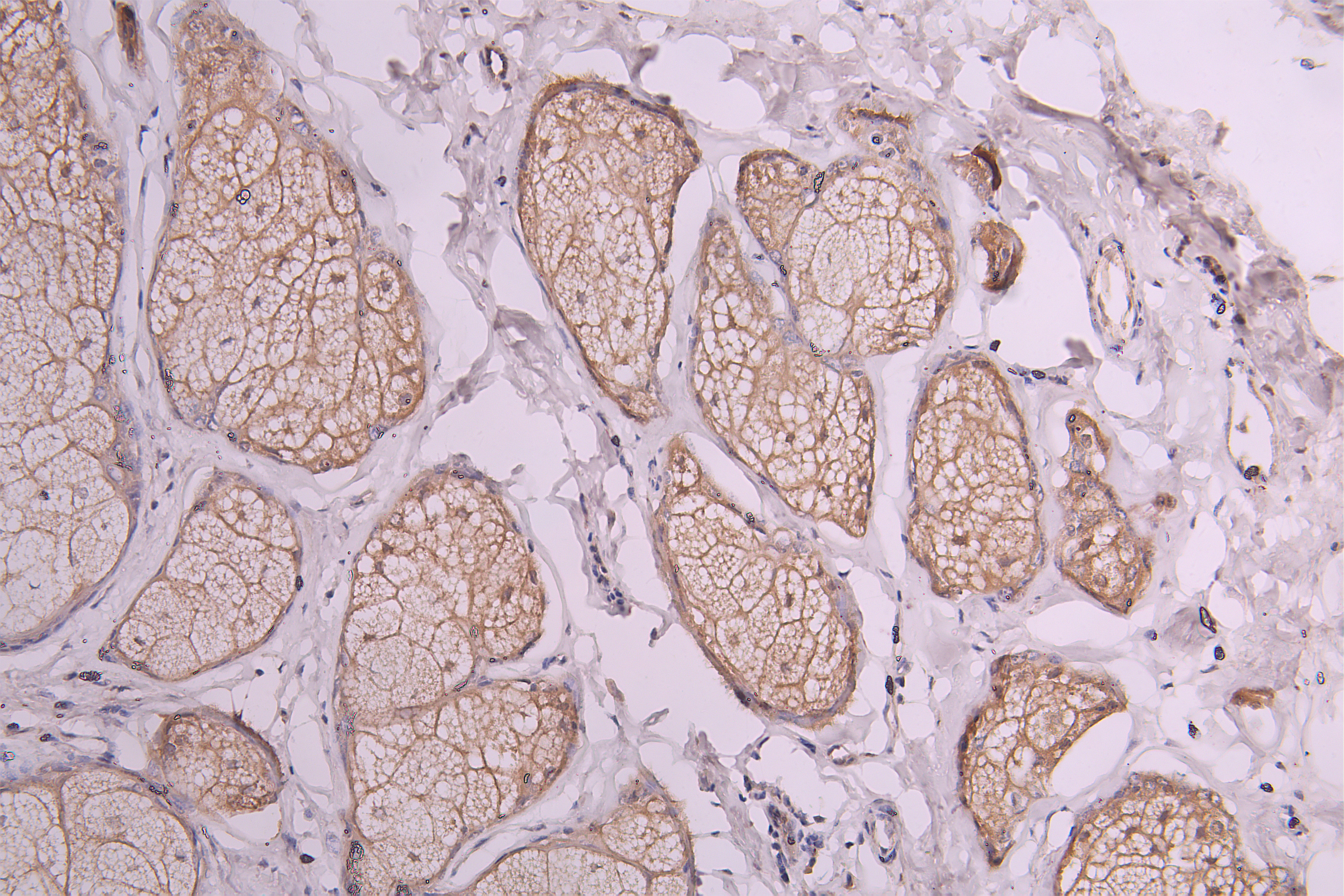 CSB-RA020888MA1HU