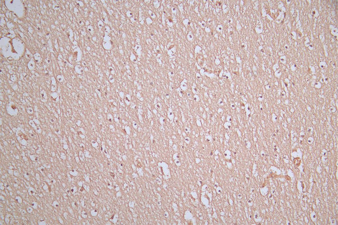 CSB-RA021912MA1HU IHC1