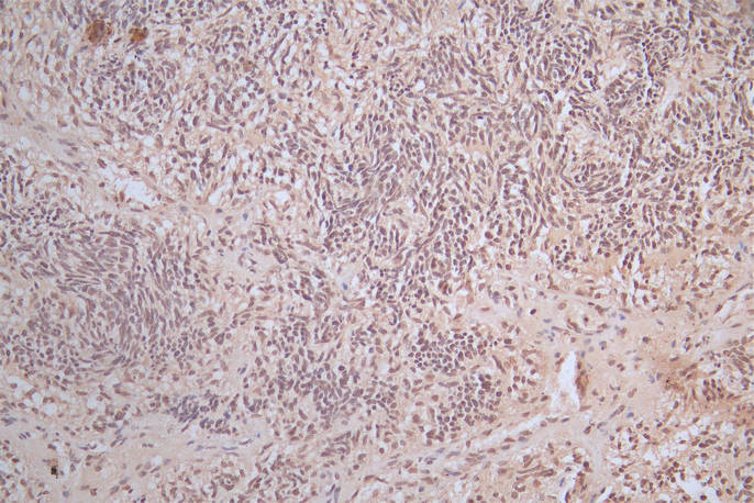 CSB-RA021912MA1HU IHC2