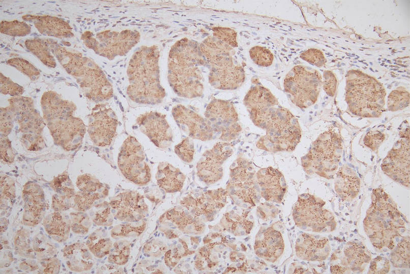 IHC image of CSB-RA022332MA1HU diluted at 1:50 and staining in paraffin-embedded human stomach tissue performed on a Leica BondTM system. After dewaxing and hydration, antigen retrieval was mediated by high pressure in a citrate buffer (pH 6.0). Section was blocked with 10% normal goat serum 30min at RT. Then primary antibody (1% BSA) was incubated at 4°C overnight. The primary is detected by a Goat anti-mouse polymer IgG labeled by HRP and visualized using 0.05% DAB.