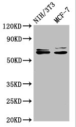 Western Blot Positive WB detected in: NIH/3T3 whole cell lysate, MCF-7 whole cell lysate All lanes: SRC antibody at 1.2microg/ml Secondary Goat polyclonal to rabbit IgG at 1/50000 dilution Predicted band size: 60, 61 KDa Observed band size: 60, 61 KDa Western Blot Positive WB detected in: NIH/3T3 whole cell lysate, MCF-7 whole cell lysate All lanes: SRC antibody at 1.2microg/ml Secondary Goat polyclonal to rabbit IgG at 1/50000 dilution Predicted band size: 60, 61 KDa Observed band size: 60, 61 KDa