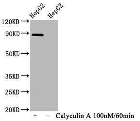 Western Blot Positive WB detected in HepG2 whole cell lysate(treated with Calyculin A or not) All lanes Phospho-STAT1 antibody at 1.065microg/ml Secondary Goat polyclonal to rabbit IgG at 1/50000 dilution Predicted band size: 87 KDa Observed band size: 87 KDa Western Blot Positive WB detected in HepG2 whole cell lysate(treated with Calyculin A or not) All lanes Phospho-STAT1 antibody at 1.065microg/ml Secondary Goat polyclonal to rabbit IgG at 1/50000 dilution Predicted band size: 87 KDa Observed band size: 87 KDa