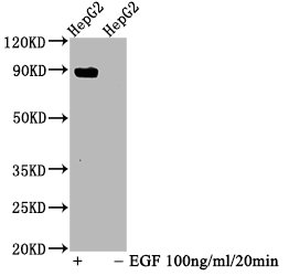 CSB-RA022814A694phHU