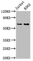 Western Blot Positive WB detected in: Jurkat whole cell lysate, K562 whole cell lysate All lanes: STIP1 antibody at 0.9microg/ml Secondary Goat polyclonal to rabbit IgG at 1/50000 dilution Predicted band size: 63, 69, 60 KDa Observed band size: 63 KDa Western Blot Positive WB detected in: Jurkat whole cell lysate, K562 whole cell lysate All lanes: STIP1 antibody at 0.9microg/ml Secondary Goat polyclonal to rabbit IgG at 1/50000 dilution Predicted band size: 63, 69, 60 KDa Observed band size: 63 KDa